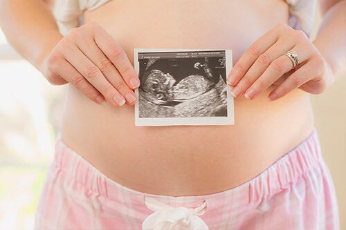 Expecting a baby